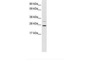 Image no. 1 for anti-DNA repair and recombination protein RAD54B (RAD54B) (AA 76-125) antibody (ABIN202190) (RAD54B 抗体  (AA 76-125))