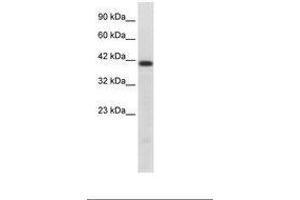 Image no. 1 for anti-HNF1 Homeobox B (HNF1B) (AA 43-92) antibody (ABIN202427) (HNF1B 抗体  (AA 43-92))