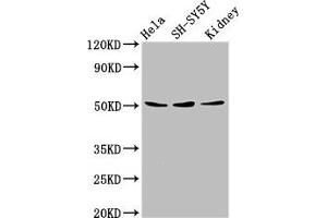 Western Blot Positive WB detected in: Hela whole cell lysate, SH-SY5Y whole cell lysate, Mouse kidney tissue All lanes: RARG antibody at 8 μg/mL Secondary Goat polyclonal to rabbit IgG at 1/50000 dilution Predicted band size: 51, 50, 43, 48 kDa Observed band size: 51 kDa