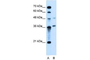 ARMCX6 antibody used at 5 ug/ml to detect target protein. (ARMCX6 抗体  (N-Term))