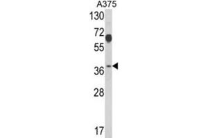 Western Blotting (WB) image for anti-Proteasome (Prosome, Macropain) 26S Subunit, Non-ATPase, 7 (PSMD7) antibody (ABIN3001710) (PSMD7 抗体)