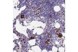 Immunohistochemical staining of human bone marrow with C15orf59 polyclonal antibody  shows strong cytoplasmic positivity in megakaryocytes at 1:500-1:1000 dilution. (C15ORF59 抗体)