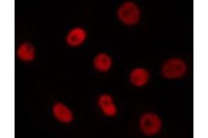 ABIN6275620 staining Hela by IF/ICC. (T-Box 18 抗体  (Internal Region))