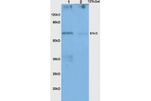 L1 human colon carcinoma lysates L2 human gastric carcinoma lysates probed with Anti CHK2 Polyclonal Antibody, Unconjugated (ABIN685867) at 1:200 in 4 °C. (CHEK2 抗体  (AA 101-250))
