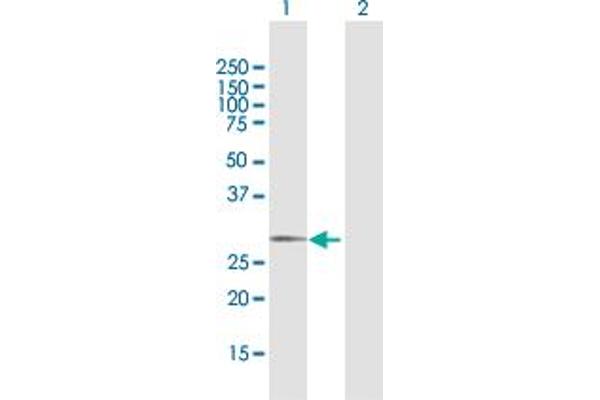 GALNT12 antibody  (AA 1-272)