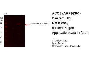 Western Blotting (WB) image for anti-Aconitase 2, Mitochondrial (ACO2) (N-Term) antibody (ABIN2786627) (ACO2 抗体  (N-Term))