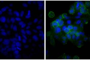 Human epithelial carcinoma cell line HEp-2 was stained with Mouse Anti-Human CD44-UNLB, and DAPI. (山羊 anti-小鼠 IgG (Heavy & Light Chain) Antibody (Biotin))