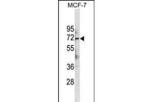 ATG13 Antibody (Center . (ATG13 抗体  (AA 333-362))