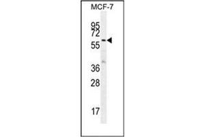 Western blot analysis of KARS Antibody (N-term) in MCF-7 cell line lysates (35ug/lane). (KARS 抗体  (N-Term))