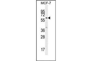 Western blot analysis of KARS Antibody (N-term) in MCF-7 cell line lysates (35ug/lane).