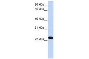 Image no. 1 for anti-Hepatitis B Virus X-Interacting Protein (HBXIP) (N-Term) antibody (ABIN6743628) (HBXIP 抗体  (N-Term))