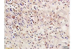 Formalin-fixed and paraffin embedded: rat brain tissue labeled with Anti-SOCS 1 Polyclonal Antibody (ABIN725135), Unconjugated 1:200 followed by conjugation to the secondary antibody and DAB staining (SOCS1 抗体  (AA 121-211))