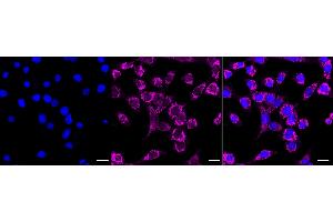 Immunocytochemical staining of C2C12 cells with PCK2 antibody (ABIN7799800), 1:1,000). (Recombinant PEPCK 抗体)