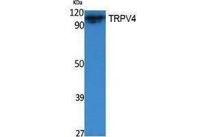 Western Blotting (WB) image for anti-Transient Receptor Potential Cation Channel, Subfamily V, Member 4 (TRPV4) (Internal Region) antibody (ABIN3187608) (TRPV4 抗体  (Internal Region))