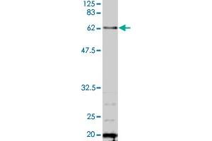 Detection of TAF6 by Western blotting using the TAF6 polyclonal antibody  . (TAF6 抗体  (AA 1-200))