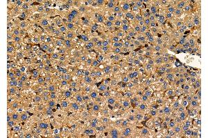 ABIN6259830 and ABIN6278075 at 1/100 staining Mouse liver tissue by IHC-P.