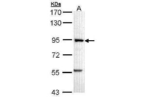 WB Image Sample (30 ug of whole cell lysate) A: A431 , 7. (PFKM 抗体  (N-Term))