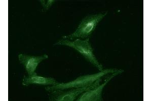 IF of Aha1 tested on HeLa cell lysates. (AHSA1 抗体)