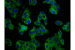 Immunofluorescence (IF) image for anti-Solute Carrier Family 11 (Proton-Coupled Divalent Metal Ion Transporters), Member 1 (SLC11A1) (AA 1-58) antibody (ABIN7161089)