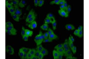 Immunofluorescence staining of HepG2 cells with ABIN7161089 at 1:100, counter-stained with DAPI. (SLC11A1 抗体  (AA 1-58))