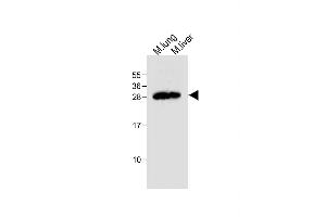 All lanes : Anti-Mouse Trem2 Antibody (N-term) at 1:500 dilution Lane 1: Mouse lung tissue lysate Lane 2: Mouse liver tissue lysate Lysates/proteins at 20 μg per lane. (TREM2 抗体  (N-Term))