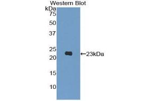 Detection of Recombinant PIK3Cb, Human using Polyclonal Antibody to Phosphoinositide-3-Kinase Catalytic Beta Polypeptide (PIK3Cb) (PIK3CB 抗体  (AA 321-507))