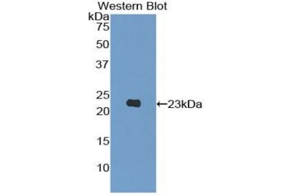 PIK3CB Antikörper  (AA 321-507)