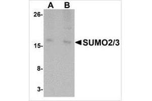 Western blot analysis of SUMO3 in rat liver tissue lysate with SUMO3 antibody at (A) and (B) 2 μg/ml. (SUMO2 抗体  (C-Term))