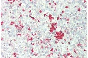 Human Spleen: Formalin-Fixed, Paraffin-Embedded (FFPE)