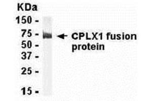 Western Blotting (WB) image for anti-Complexin 1 (CPLX1) (AA 1-134) antibody (ABIN2468059) (Complexin 1 抗体  (AA 1-134))