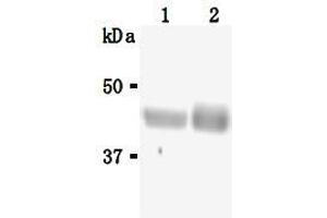 Western Blotting (WB) image for anti-Sialidase 3 (Membrane Sialidase) (Neu3) antibody (ABIN1449196) (Neu3 抗体)
