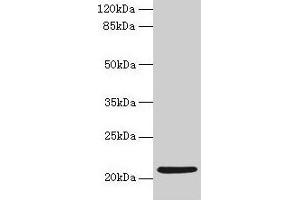 Western blot All lanes: COPZ1 antibody at 1 μg/mL + K562 whole cell lysate Secondary Goat polyclonal to rabbit IgG at 1/10000 dilution Predicted band size: 21, 15, 18, 22, 19 kDa Observed band size: 21 kDa (COPZ1 抗体  (AA 1-177))