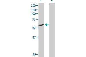 Western Blotting (WB) image for anti-Cytochrome P450, Family 2, Subfamily A, Polypeptide 6 (CYP2A6) (AA 1-494) antibody (ABIN514823)