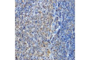 Immunohistochemistry of paraffin-embedded rat spleen using  Rabbit pAb (ABIN6127370, ABIN6137127, ABIN6137128 and ABIN6214982) at dilution of 1:100 (40x lens). (ARPC2 抗体  (AA 1-300))