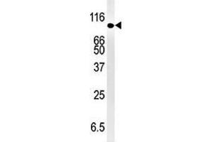 Image no. 1 for anti-SMAD Specific E3 Ubiquitin Protein Ligase 1 (SMURF1) (N-Term) antibody (ABIN357469) (SMURF1 抗体  (N-Term))