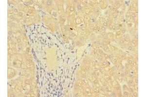 Immunohistochemistry of paraffin-embedded human liver tissue using ABIN7158927 at dilution of 1:100 (MR1 抗体  (AA 150-253))