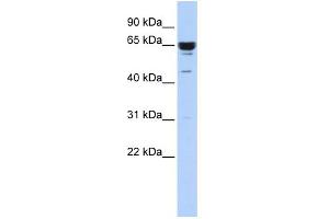 WB Suggested Anti-ZNF587 Antibody Titration:  0. (ZNF587 抗体  (Middle Region))