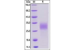 SDS-PAGE (SDS) image for Placenta Growth Factor (PGF) (AA 19-158) (Active) protein (His tag) (ABIN6253571)