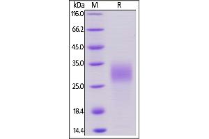 Mouse PLGF, His Tag on  under reducing (R) condition. (PLGF Protein (AA 19-158) (His tag))