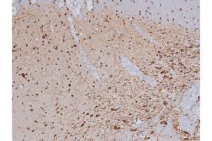 ABIN6267327 at 1/200 staining Rat brain tissue sections by IHC-P. (Tyrosine Hydroxylase 抗体  (pSer19))