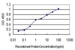 Detection limit for recombinant GST tagged RARB is approximately 0. (Retinoic Acid Receptor beta 抗体  (AA 1-100))