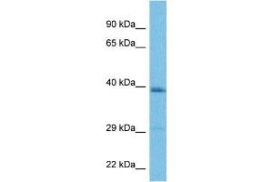 Host:  Rabbit  Target Name:  LAPTM4B  Sample Tissue:  Human MDA-MB-435s Whole Cell  Antibody Dilution:  1ug/ml (LAPTM4B 抗体  (Middle Region))
