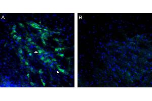 anti-Potassium Inwardly-Rectifying Channel, Subfamily J, Member 9 (KCNJ9) (AA 344-361), (Intracellular) antibody