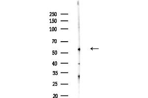 Western blot analysis of lysates from F10-LUC cells(heat-shock,45 min treatment), using CC Antibody at 1/1000 dilution.