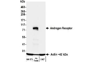 Western Blotting (WB) image for anti-Androgen Receptor (AR) (AA 1-50) antibody (ABIN7795785)