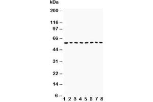 Western blot testing of Beclin 1 antibody and Lane 1:  COLO320;  2: HepG2;  3: PANC;  4: A431;  5: SMMC-7721;  6: Jurkat;  7: SW620;  8: U87 lysate. (Beclin 1 抗体  (AA 1-354))
