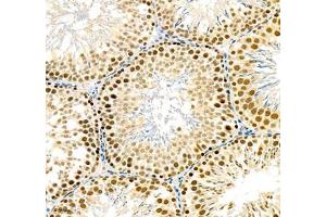 Immunohistochemistry (Paraffin-embedded Sections) (IHC (p)) image for anti-General Transcription Factor IIB (GTF2B) antibody (ABIN7074034)