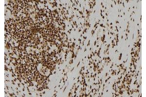 ABIN6278423 at 1/100 staining Human gastric tissue by IHC-P. (ASCL1 抗体  (C-Term))