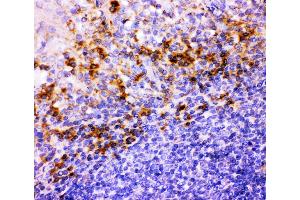 Anti-ITGB1 Picoband antibody,  IHC(P): Human Tonsil Tissue (ITGB1 抗体  (AA 527-728))