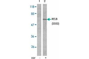 Western blot analysis of extracts from A431 cells untreated or treated with EGF (200 ng/mL 10 min) using RELB (phospho S552) polyclonal antibody . (RELB 抗体  (pSer552))